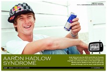 Aaron Hadlow Syndrome
