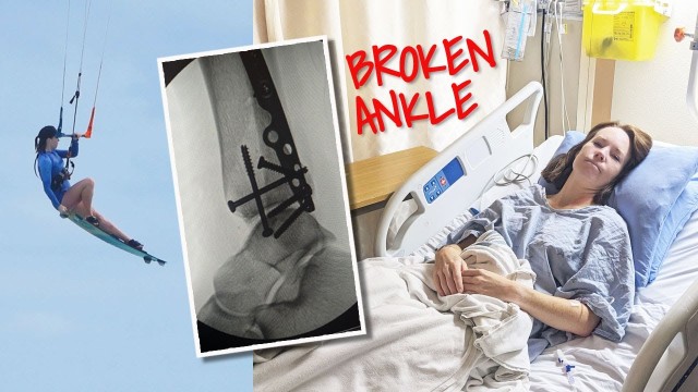 I Broke My Ankle Kiteboarding - VLOG #50