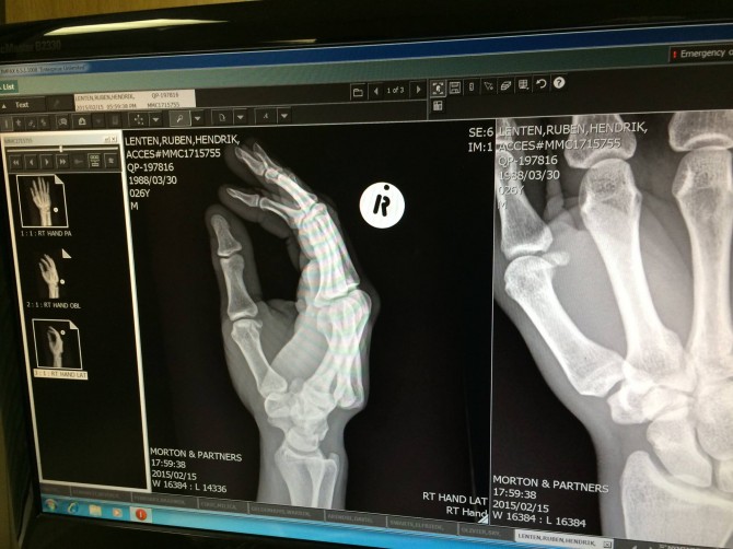 The X-Ray - Photo: Ruben Lenten