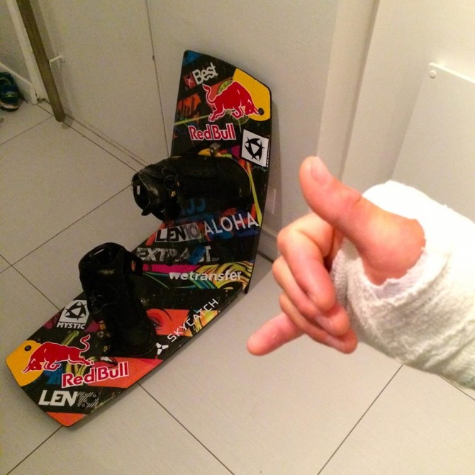 The outcome... Heal up soon Ruben!