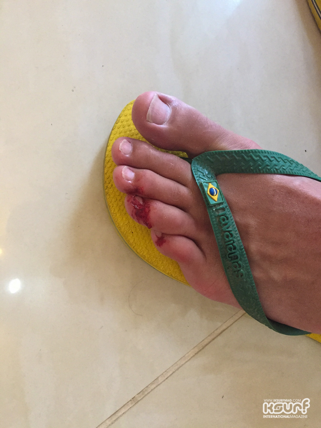 You should see the bottom of my foot, it's worse...