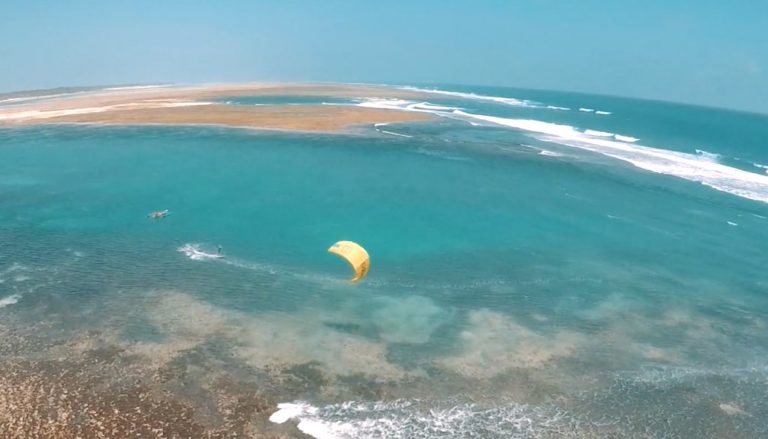 'The Dent-est' in Zanzibar