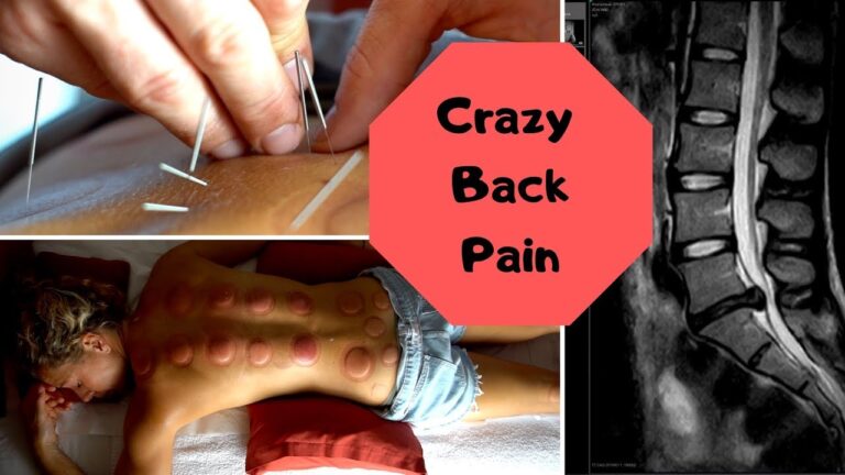 CRAZY Back Pain!